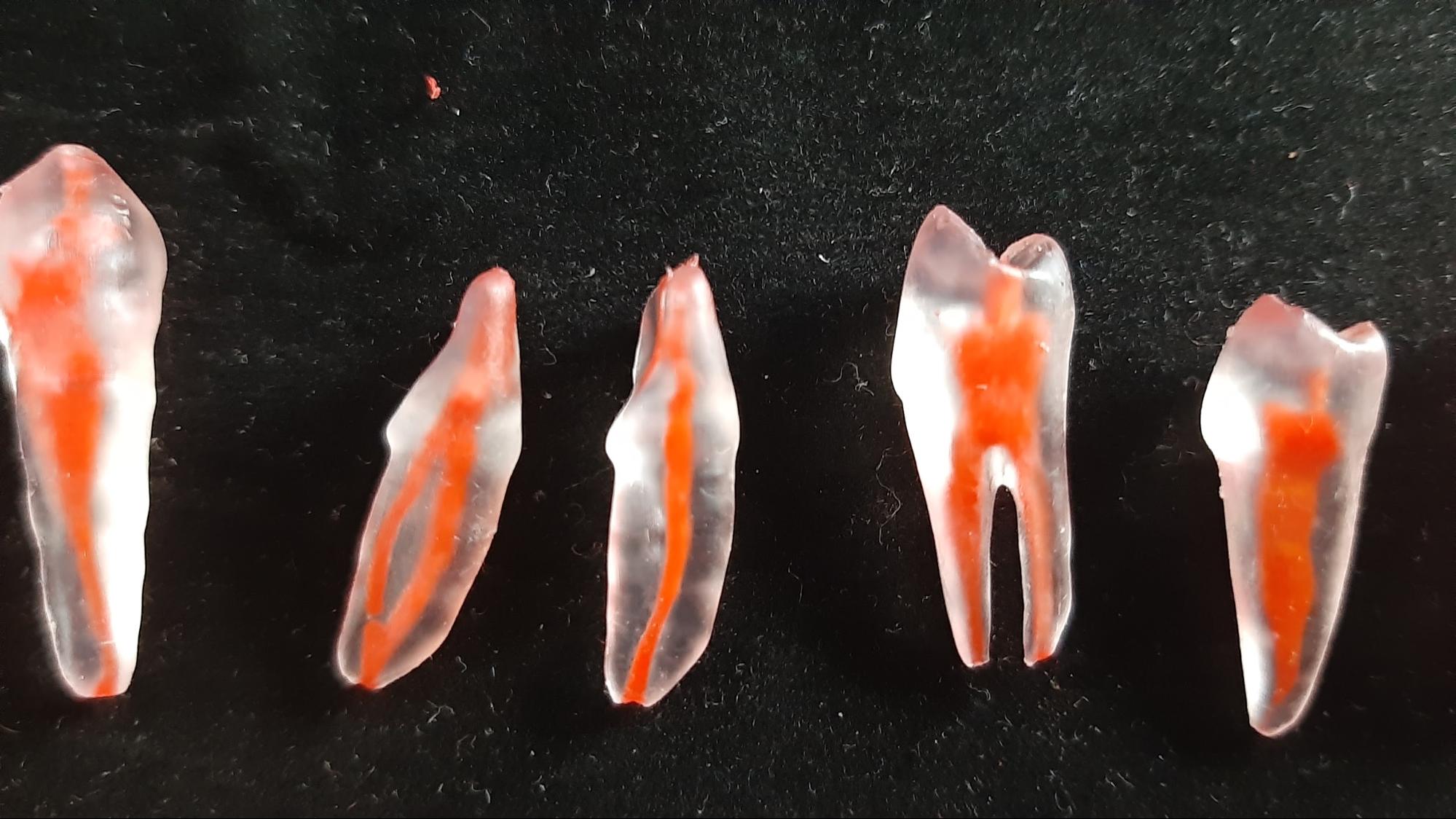 3D Printed Teeth Models Support Dentistry Education at Home During