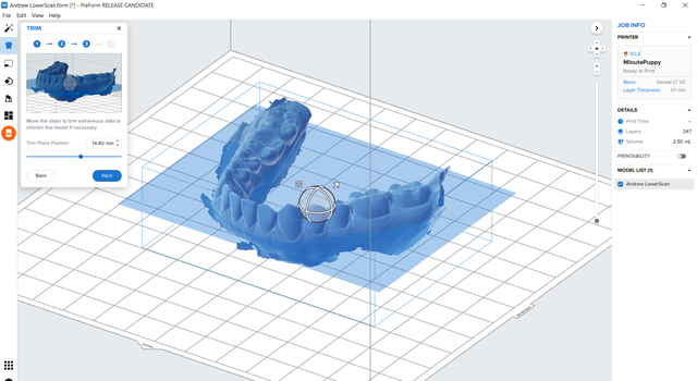 Scan to Model: Convert Digital Scans Into Printable Dental Models in ...