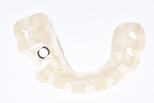 Delivering Precision With Predictability: Why Guided Dentistry and 3D ...