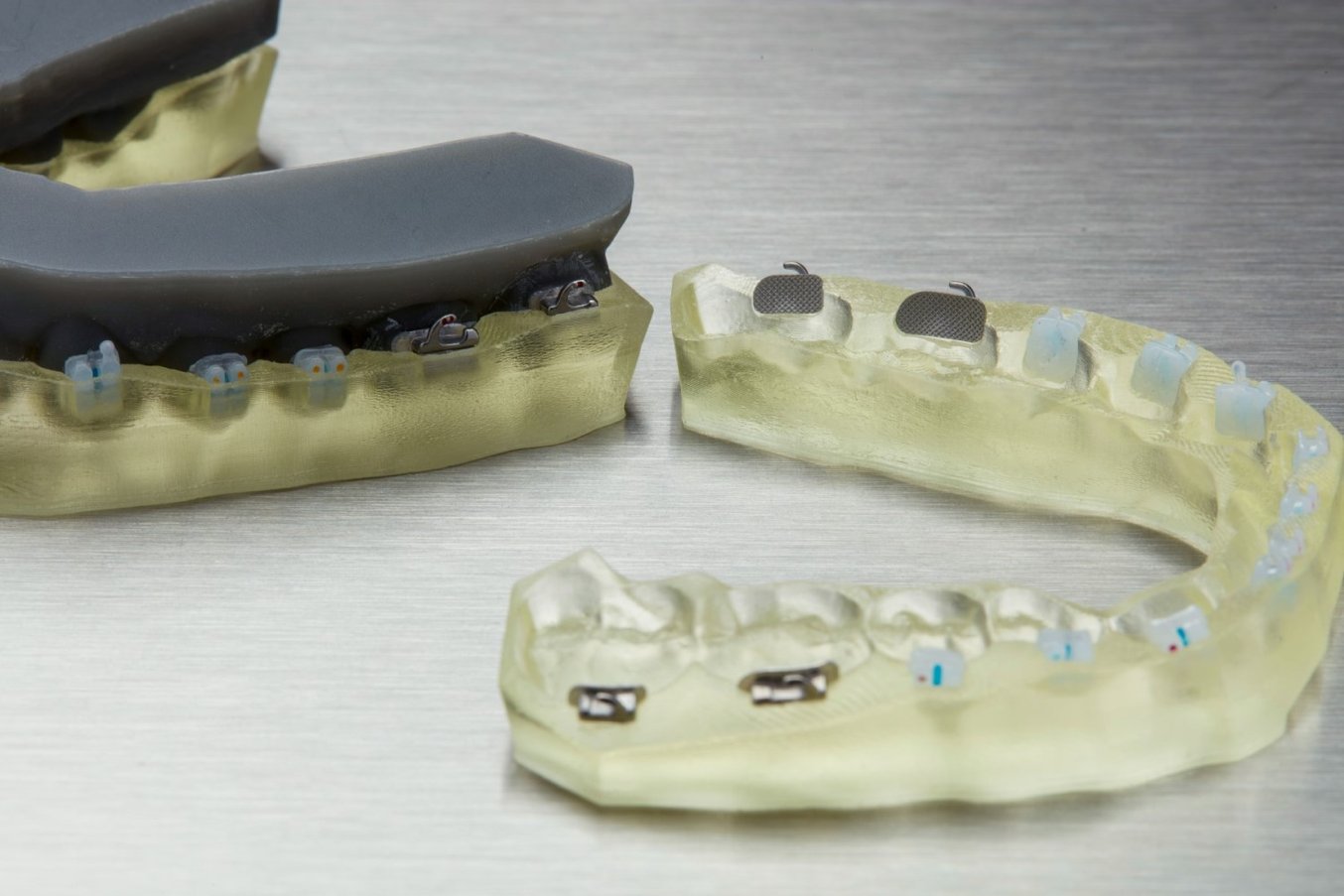 Quelle Contention Invisalign Choisir ? Que Penser De La Contention – NAVTFV