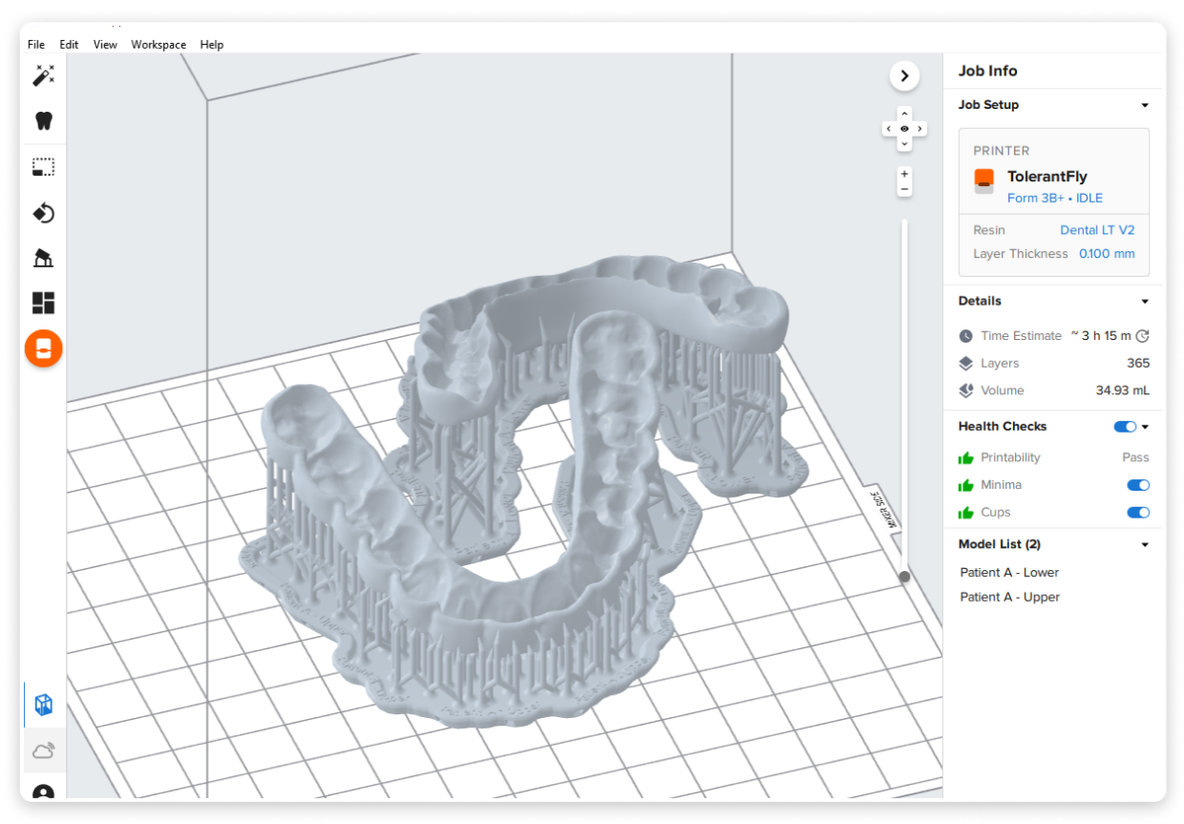 The New Standard in Dental Print Preparation Software | Formlabs 