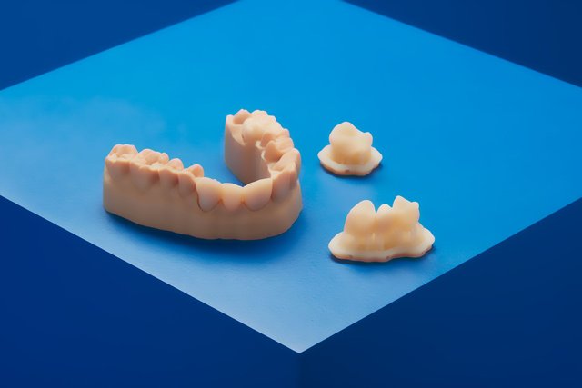 Temporary Restorations With 3D Printing | Formlabs Dental